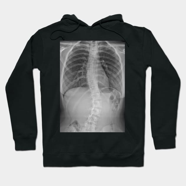 X ray hoodie shop